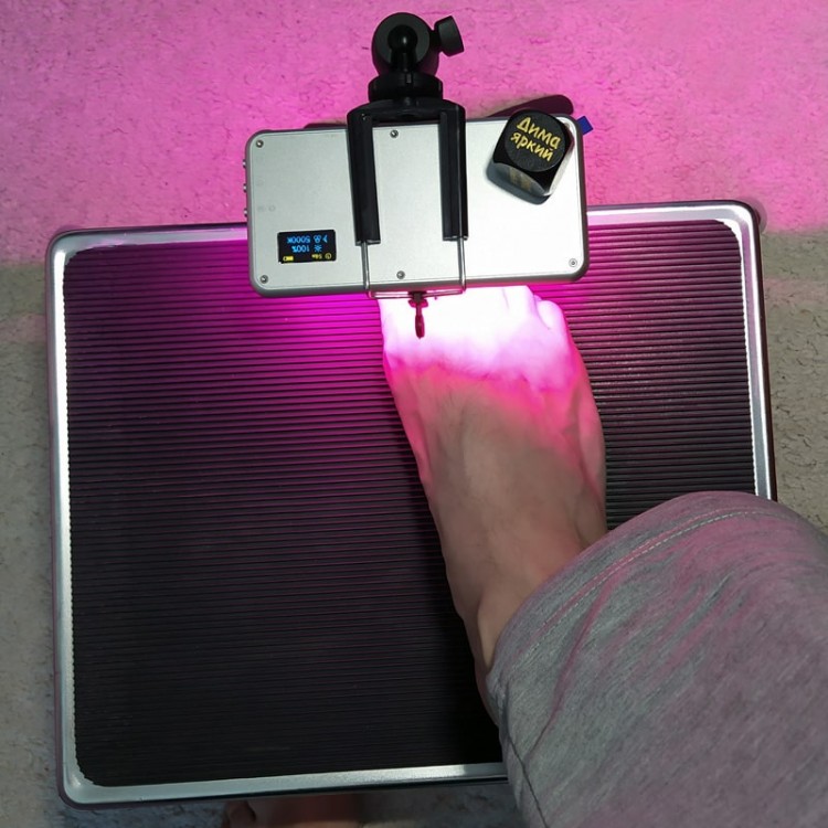 Индивидуальный аппарат для ФДТ Mini Led (Light) в действии  Индивидуальный аппарат для ФДТ Mini Led (Light) в действии