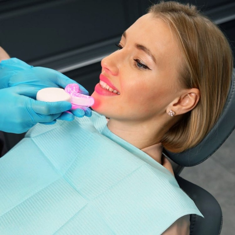 Капа фотодинамической стоматологии Dental Led (battery) у врача Капа фотодинамической стоматологии Dental Led (battery) у врача